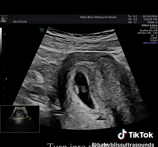 Amazing Growth in Pregnancy: From First to Second Trimester