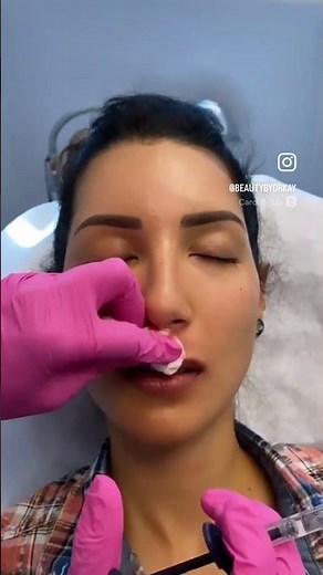 What's a Cupid's Bow and why is it called that?? 🤔