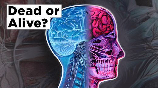 15K views · 11 reactions | About 50 years ago, doctors came up with a new definition for death. Brain death occurred when a person's brain could no longer support the body. But brain death isn't as cut and dried as we would like to think. Cheddar explains the blurred lines of brain death and how you can be declared legally dead in one place, but alive in another. | Cheddar Originals | Facebook