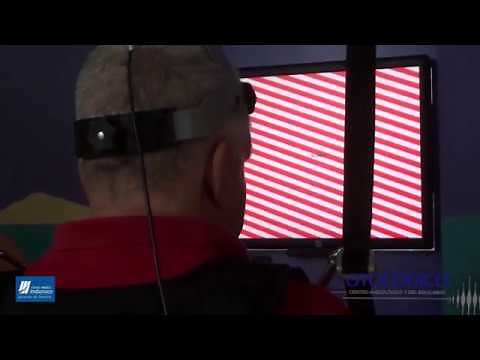 Posturografía dinámica computarizada - - Otológico - - Clínica Imbanaco - -