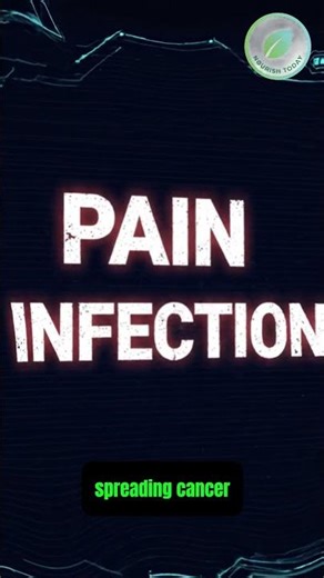 Prostate Biopsy Myths: Pain, Infection, “Spreading Cancer?”