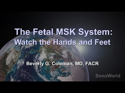 "The Fetal MSK System: Watch the Hands and Feet" Ultrasound SonoWorld Lecture