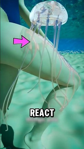 How Does Your Body React to a Jellyfish Sting 🌊