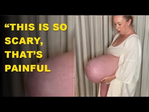 Large breasted mom | Mom’s giant baby bump that goes ‘straight out’ leaves the internet speechless