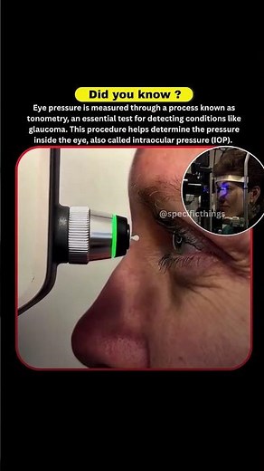 Understanding Tonometry: How Eye Pressure Is Measured to Detect Glaucoma . #shortsfeed #didyouknow