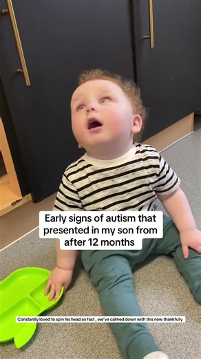 Understanding the Different Signs of Autism in Toddlers