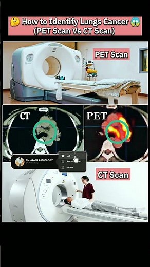 🩻Pet scan Vs CT scan😱 #cancer #medicalimaging #ctscan #petscan #lungcancer #howto #youtubeshorts #yt