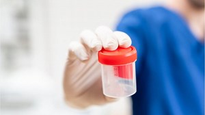 Life after death: Should dead men become sperm donors? - National | Globalnews.ca