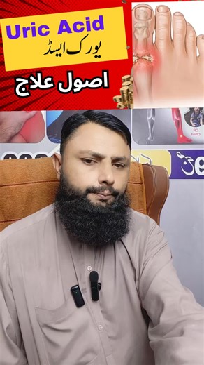 How to Reduce Uric Acid Naturally: A Complete Guide