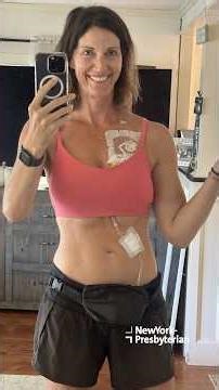 Cancer-free After Stage IV Colon Cancer