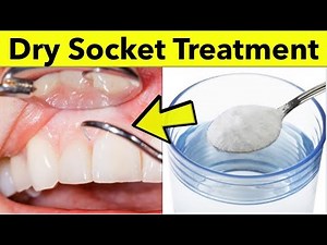 How to Treat Dry Socket After Tooth Extraction | Natural Dry Socket Treatment at Home