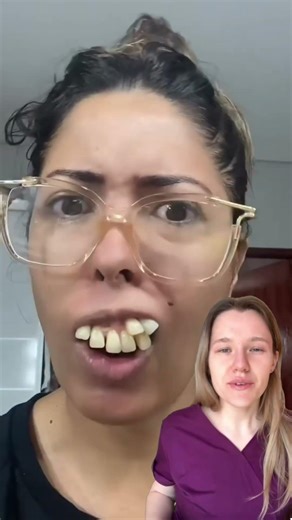 What is hyperdontia?