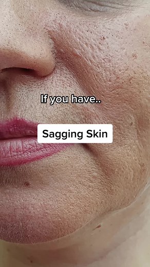 Transform Your Skin with Matrixyl 3000 Serum