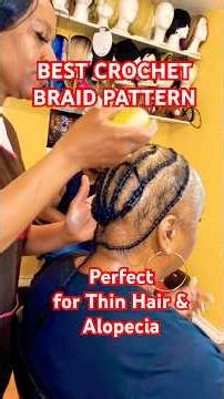 “Why This Is the SAFEST Braid Pattern for Alopecia & Thin Hair”
