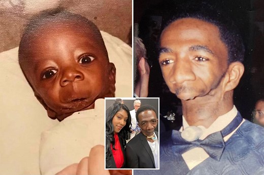 Man born without a jaw finds love after lifetime of pain: ‘I deserved more’