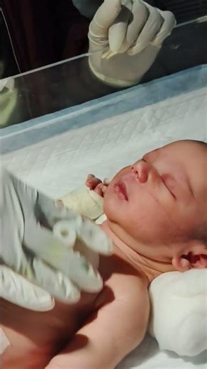 Newborn baby being chestrpy 😌👍#youtubeshorts #nursing #newbornbaby #chestrip #cutevideo #nicuvairal