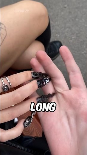 His Fused Fingers Made Him Famous! ✨😱 (@Kvilzy)