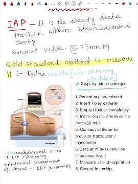 How pressure buildup affects your abdomen #medical #anatomy