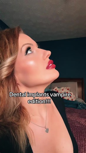 #powerdentalstudio #implants #allonx #implantteeth #vampire I freaking love my fangs