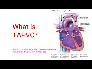 What is TAPVC?