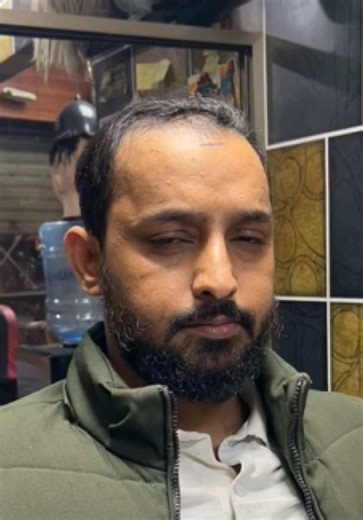 Soft Silky Hair Patches for Gorgeous Hair