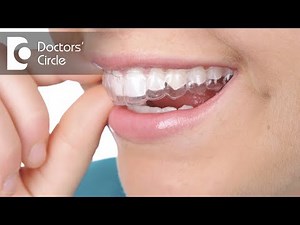 What are aligners for teeth? - Dr. Aniruddha KB