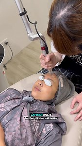 32K views · 484 reactions | wajib banget kombinasi treatment PRP + pico laser, buat masalah flek hitam, bekas jerawat atau warna kulit gak merata „ dijamin Hasilnya wajah jadi tambah glowing殺 | Fitri Naia | Facebook
