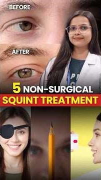 5 Non-Surgical Ways to Treat Squint Eyes