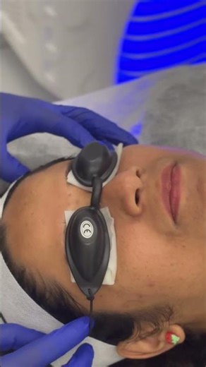 Laser Toning Treatment for Glowing Skin | Pigmentation & Tan Removal