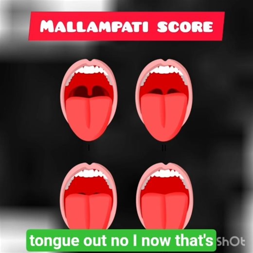 Mallampati score song #mbbs #viral