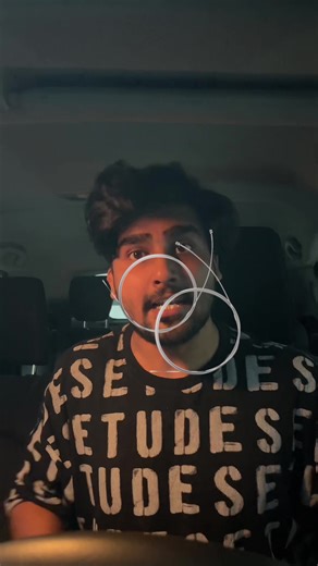 Easy Guitar Lesson for Beginners: Simple Strumming Patterns