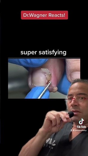 INGROWN TOENAIL WITH ABSCESS 😩#shorts #abscess