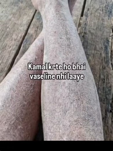 bittu memer😉 on Instagram: "日本利用压电瓷砖将脚步转化为电能。这些瓷砖捕捉来自你脚步的动能。当你行走时,你的重量和动作会对瓷砖产生压力。瓷砖会轻微弯曲,从而产生机械应力。瓷砖内部的压电材料将这种应力转化为电能。每一步都会产生少量电荷,而数百万步结合在一起就能产生足够的电力来驱动 LED 灯、数字显示屏和传感器。在像涩谷车站这样繁忙的地方,每天大约有240 万个脚步为这一系统作出贡献。这些电能可以被储存或立即使用,从而减少对传统电力来源的依赖,并支持可持续的城市基础设施。这种方法将日常运动转化为实用的可再生能源 #日本 #知识 #事实#你知道吗 #推荐 #科技 #创新 #历史 #技术 #实验 #热门"