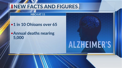 Alzheimer's Association releases Facts and Figures Report for 2025