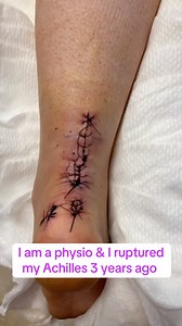 I’m a physical therapist… and I ruptured my Achilles. Three years ago, everything changed. I lost my strength. I lost my identity. I struggled with depression. And I had to relearn how to walk, how to trust my body again, and how to rebuild from scratch. This video shows real clips from my first 6 months of rehab — including when I reruptured at 14 weeks post-op. & Yes, even with a major setback… I still got back to Olympic weightlifting. & running. & jumping. And I did it safely and intentional