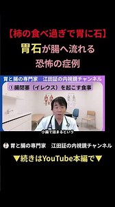 【腸閉塞の原因】柿の食べ過ぎは危険？カチカチの胃石が小腸に詰まる恐怖の食事性イレウス