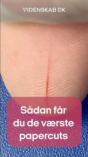 Sådan får du de værste papercuts