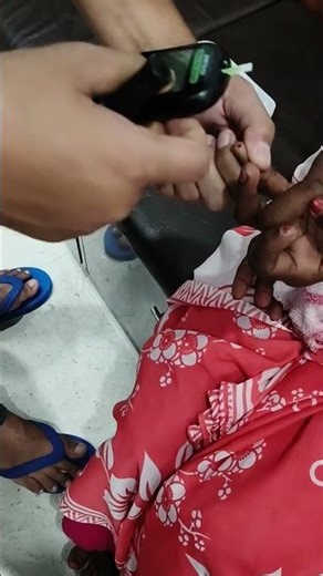 Glucose Test #paramedical #nursing #paramedicalboyz