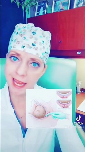 Membrane sweeping in pregnancy!