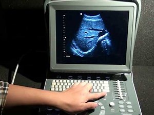 CHISON ECO1 Vet - How To Operate And Use In Animal Echosonography Scanning