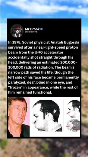 In 1978, Soviet physicist Anatoli Bugorski survived after a near-light-speed proton