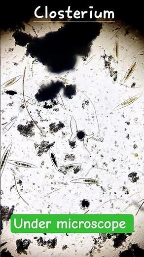 Closterium Explained! Unicellular Green Alga Structure & Life Cycle | BioCrack with Ranjan #shorts