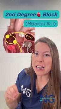 Heart blocks made easy!