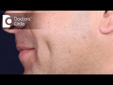 What is dimple creation & its procedure? - Dr. Girish A C | Doctors' Circle