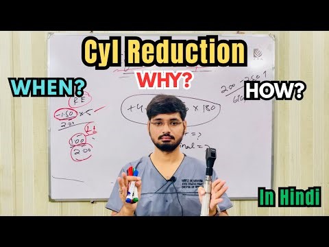 Cylinder Reduction Made Easy | Indications, Step-by-Step Method & Clinical Tips