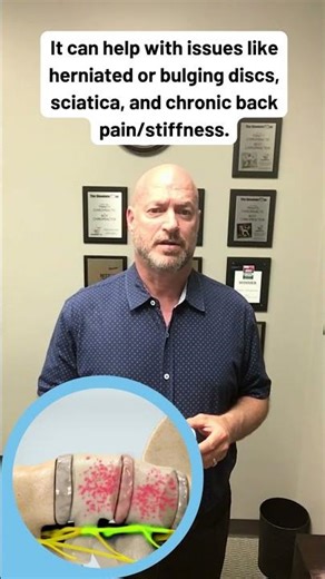 What Are The Benefits of Spinal Decompression