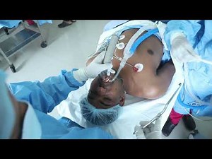 Young Man Slowly Passing Out Due to Anesthesia