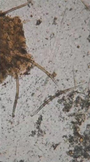 🤯 You’ve Never Seen an Egg Like This Before . Microscope View 🔬