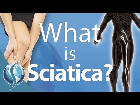 What Is Sciatica?