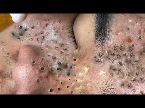 𝑹𝒆𝒎𝒐𝒗𝒊𝒏𝒈 𝑯𝒊𝒅𝒅𝒆𝒏 𝑫𝒊𝒓𝒕 𝑭𝒓𝒐𝒎 𝑷𝒐𝒓𝒆𝒔 | 𝑺𝒐𝒐𝒕𝒉𝒊𝒏𝒈 & 𝑺𝒂𝒕𝒊𝒔𝒇𝒚𝒊𝒏𝒈 #𝟐𝟏𝟗𝟖